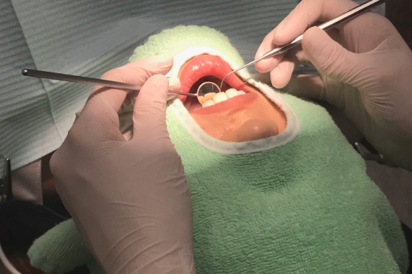 口腔内の検査
